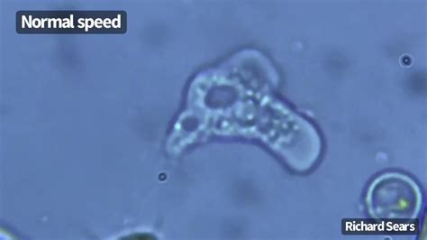  Naegleria: Um Predador Microscópico com um Apetite Voraz por Bactérias!